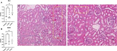 Insights into the mechanisms of triptolide nephrotoxicity through network pharmacology-based analysis and RNA-seq